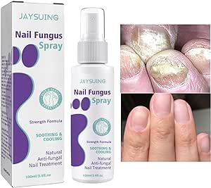 Nail Fungus Spray - My Store